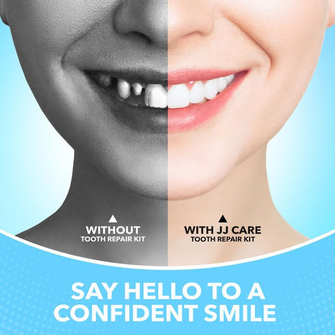 JJ CARE Tooth Repair Kit, Dental Care Kit Repair for Broken Teeth, Temporary Tooth Filling for Broken Chipped Teeth, Missing Teeth, Crown Fillings & Bridges