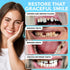 JJ CARE Tooth Repair Kit, Dental Care Kit Repair for Broken Teeth, Temporary Tooth Filling for Broken Chipped Teeth, Missing Teeth, Crown Fillings & Bridges