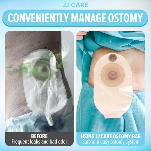 JJ CARE Colostomy Bags 20 PCS, One-Piece Pouching Ostomy Bags, No Mess Ostomy Supplies for Ileostomy, Colostomy, Urostomy Stoma Care with Odor Barrier, Drainable Ostomy Pouch with Cut to Fit Closure
