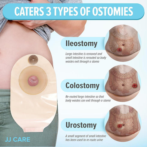JJ CARE Colostomy Bags 20 PCS, One-Piece Pouching Ostomy Bags, No Mess Ostomy Supplies for Ileostomy, Colostomy, Urostomy Stoma Care with Odor Barrier, Drainable Ostomy Pouch with Cut to Fit Closure