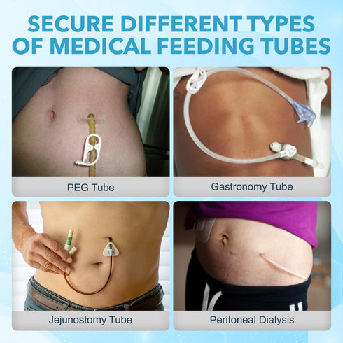 JJ CARE Feeding Tube Belt (Small), Breathable PEG Tube Belt, Nylon Fabric Gtube Belt Compatible with PEG Tubes and Gastrostomy Tubes, Adjustable and Washable G Tube Holder