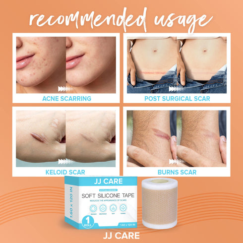 JJ CARE Soft Silicone Tape, 1.6” x 120” Flexible Silicone Scar Tape, Medical Grade Silicone Strips for Scars, Washable & Reusable Scar Tape for Surgical Scars, Latex-Free Scar Tape