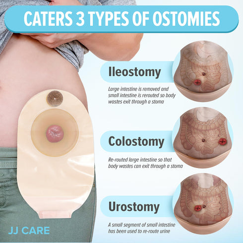 JJ CARE Colostomy Bags 20 PCS, One-Piece Pouching Ostomy Bags, No Mess Ostomy Supplies for Ileostomy, Colostomy, Urostomy Stoma Care with Odor Barrier, Drainable Ostomy Pouch with Cut to Fit Closure