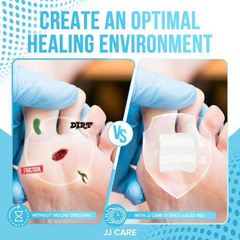 JJ CARE Sterile Gauze Pads 2" x 2" (Pack of 100), 12-Ply Cotton Gauze Pads, Individually-Wrapped Sterile Gauze Sponges, 100% Woven, Non-Stick Medical Gauze Pads for First Aid Kit & Wound Care