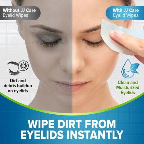 JJ CARE Eyelid Cleaning Wipes 80 PCs, Individually Wrapped Eye Lid Scrubbing Wipes, Moisturizing Eye Wipes for Irritated, Itchy, and Dry Eyes, Hypoallergenic Eye Scrub Cleaning Pads