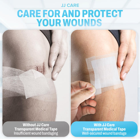 JJ CARE Transparent Medical Tape (Pack of 12), 1 x 10 yards Clear Surgical Tape for Wounds, No Residue Medical Tape, Clear First Aid Tape Roll and Easy-Tear Medical Tape for Wound Care