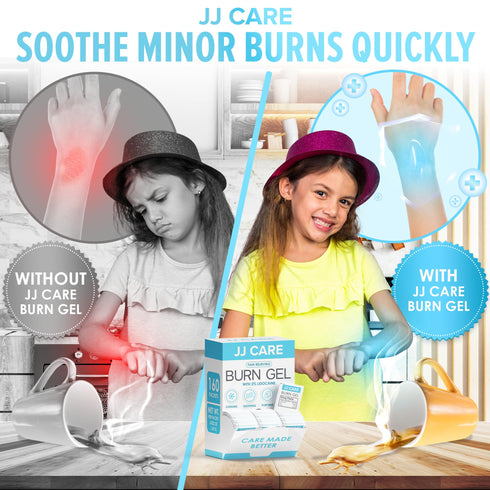 JJ CARE Burn Gel (Pack of 160), Soothing Burn Gel Packets for Minor Burns, First Aid Burn Gel Individual Packets with Lidocaine and Aloe Vera (0.9 Grams per Packet)