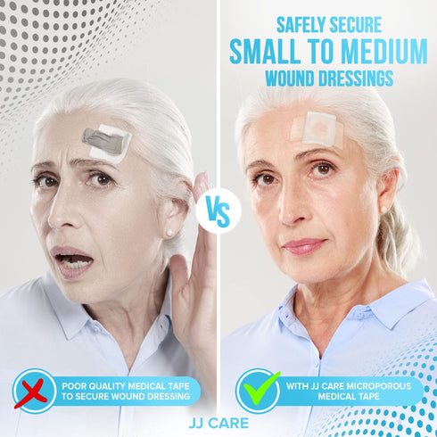 JJ CARE Micropore Tape 2” x 10 Yards - Breathable Paper Tape Medical Use, Latex-Free Paper Surgical Tape, Individually Boxed Paper Bandage Tape Rolls